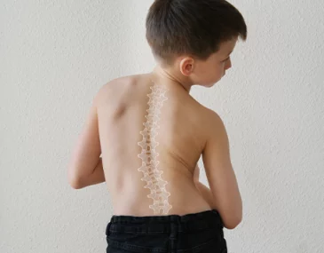 scoliosis therapy for children