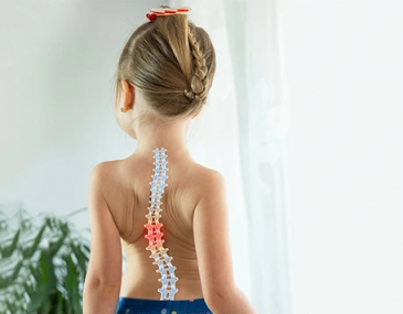scoliosis therapy for children